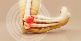 Ревматизм: признаки, причины и методы диагностики и лечения