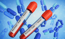 Картинка - ALEX³: НОВИЙ РІВЕНЬ МОЛЕКУЛЯРНОЇ АЛЕРГОДІАГНОСТИКИ В ДІЛА