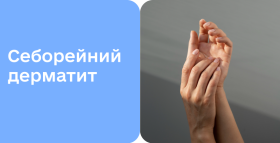 Картинка - Себорейний дерматит: від причин до лікування