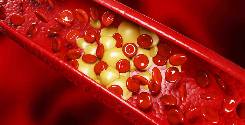 Фото - Холестерин: чим загрожує, як контролювати та коли потрібно пройти дослідження