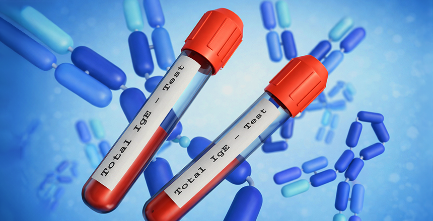 Фото - ALEX³: НОВЫЙ УРОВЕНЬ МОЛЕКУЛЯРНОЙ АЛЛЕРГОДИАГНОСТИКИ В ДІЛА