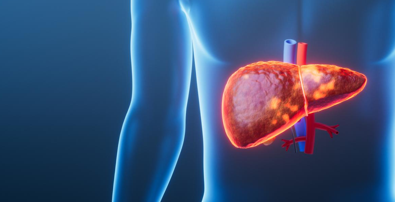 Фото - МАСХП та МетАХП: нова термінологія, лабораторна діагностика та розбір клінічного випадку