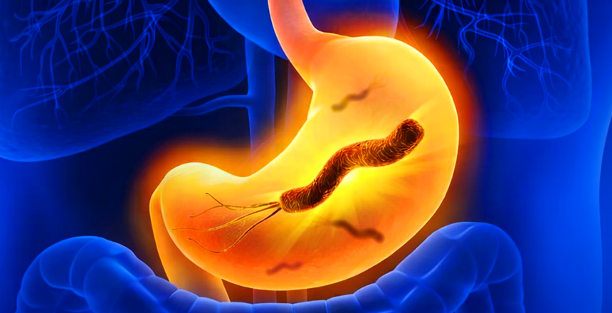 Фото - СОВРЕМЕННЫЕ ДИАГНОСТИЧЕСКИЕ РЕШЕНИЯ В ДІЛА: Хеликобактериоз, Helicobacter pylori антиген в кале, моноклональные антитела количественное определение