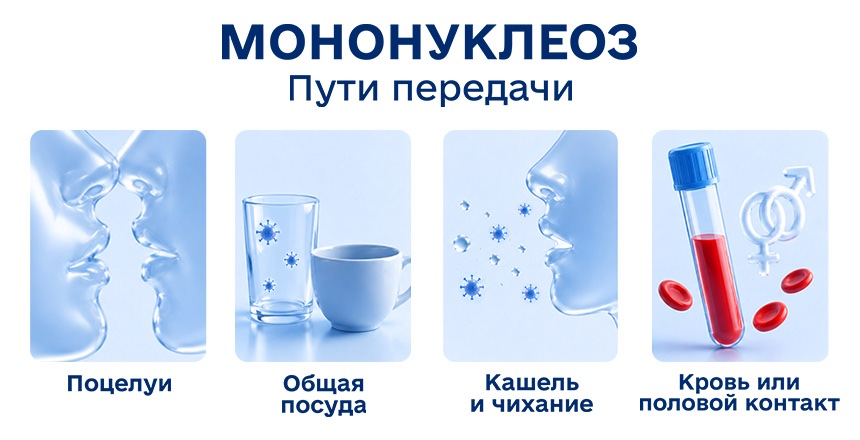 пути передачи мононуклеоза